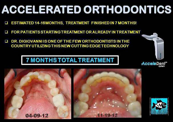 accelerated-orthodontics.jpg